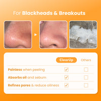 Clarity Nose Strip