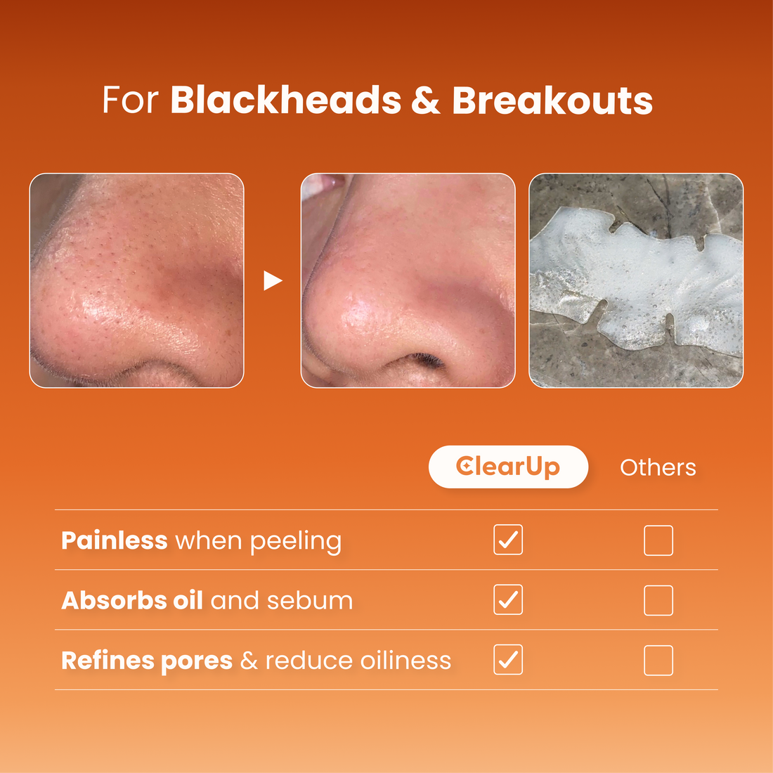 Clarity Nose Strip