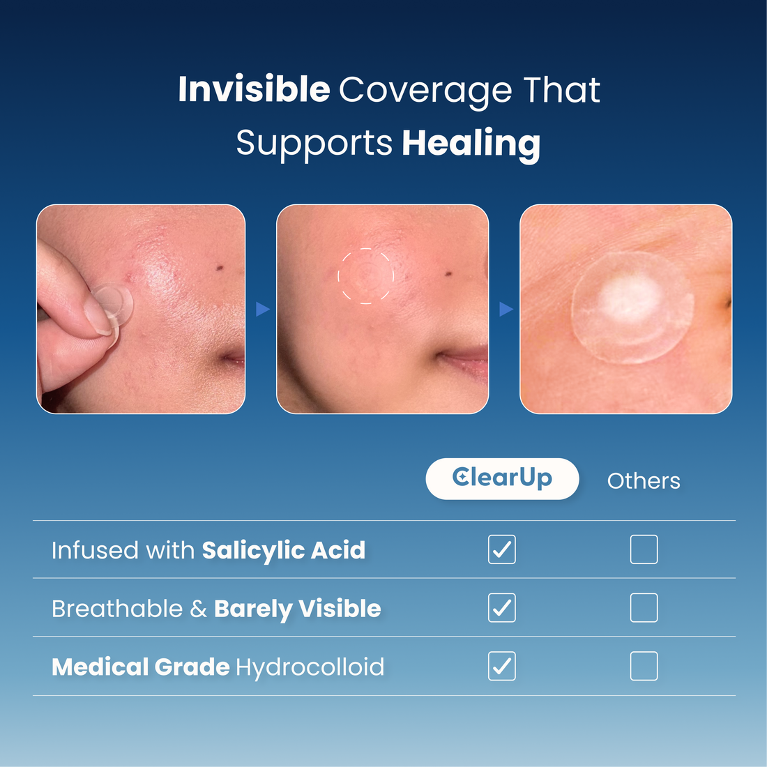 InvisiPatch