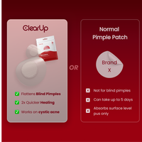 Microdarts for Acne