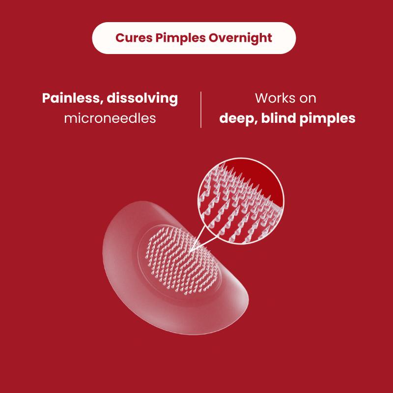 Microdarts for Acne – ClearUp