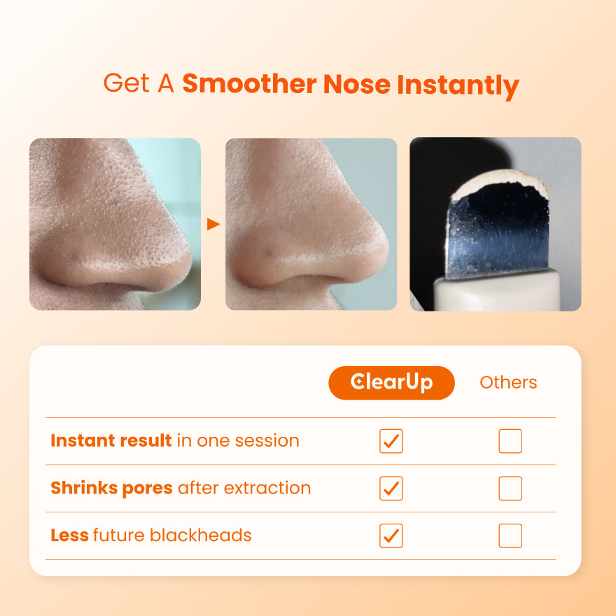 Blackhead Buster