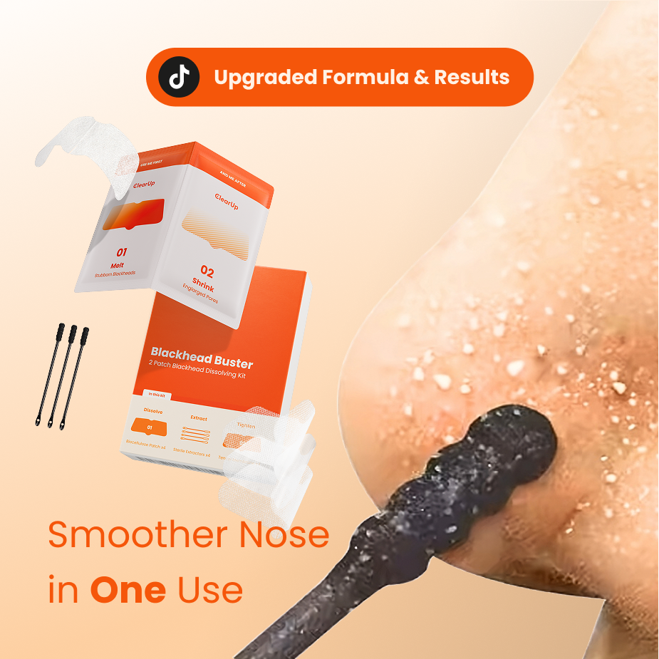 Blackhead Buster