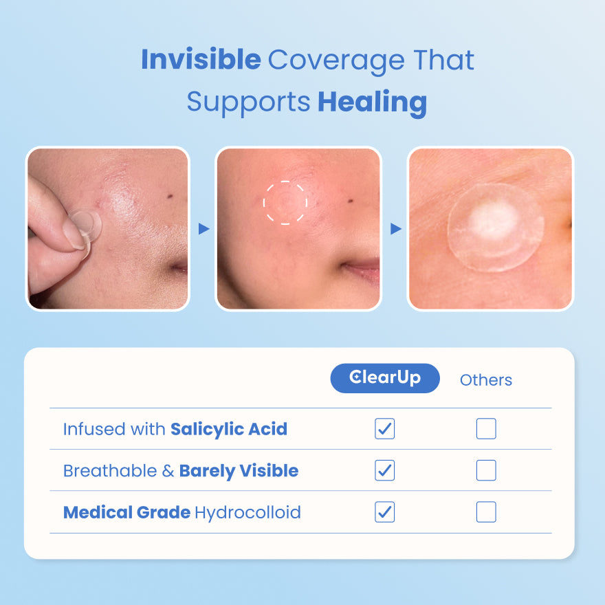 InvisiPatch