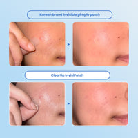 InvisiPatch
