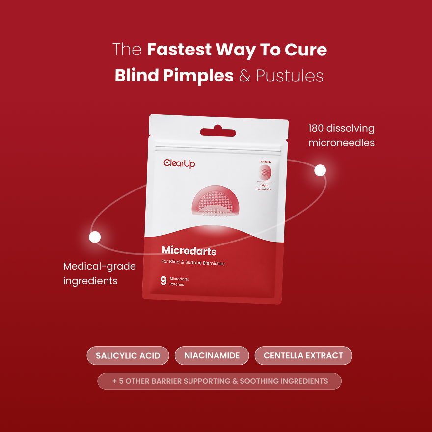 Microdarts for Acne
