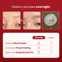Microdarts for Acne